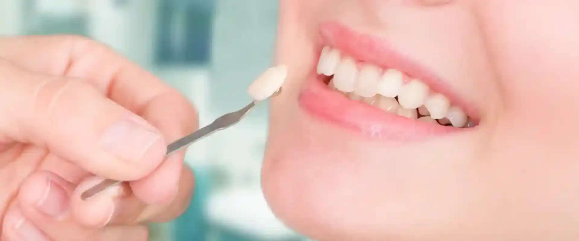 Cosmetic Dentistry Ryde