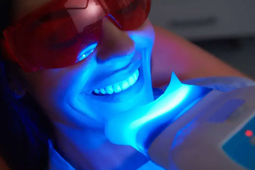 Teeth Whitening Putney
