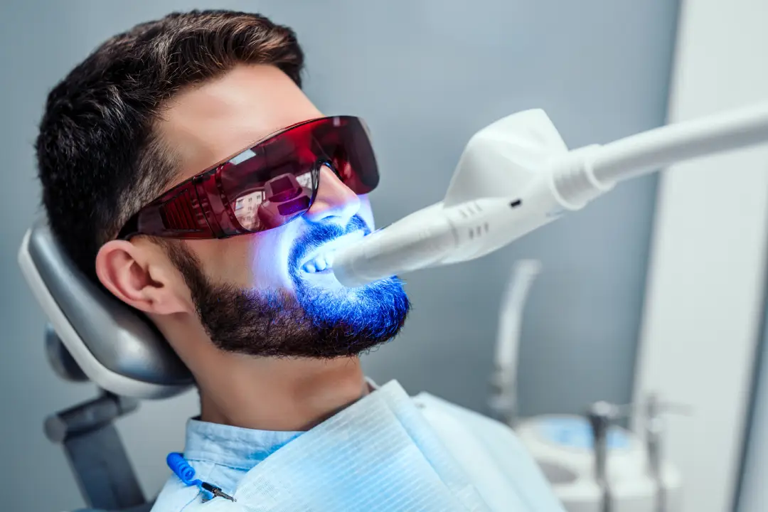 Teeth Whitening Putney
